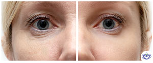 Age Spots Treatment Specialist Near Me in Aptos, CA Age Spots Treatment Specialist Near Me in Aptos, CA
