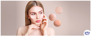 Rosacea Treatment Specialist Near Me in Aptos, CA Rosacea Treatment Specialist Near Me in Aptos, CA