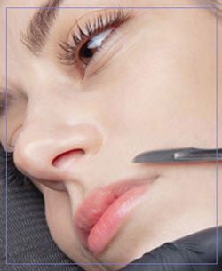 Dermaplaning Treatment in Aptos, CA