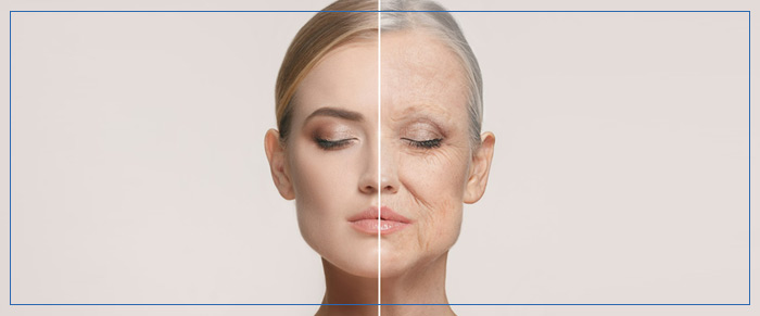 Hyperdilute Radiesse Treatment Specialist Near Me in Aptos CA Hyperdilute Radiesse Treatment Specialist Near Me in Aptos CA