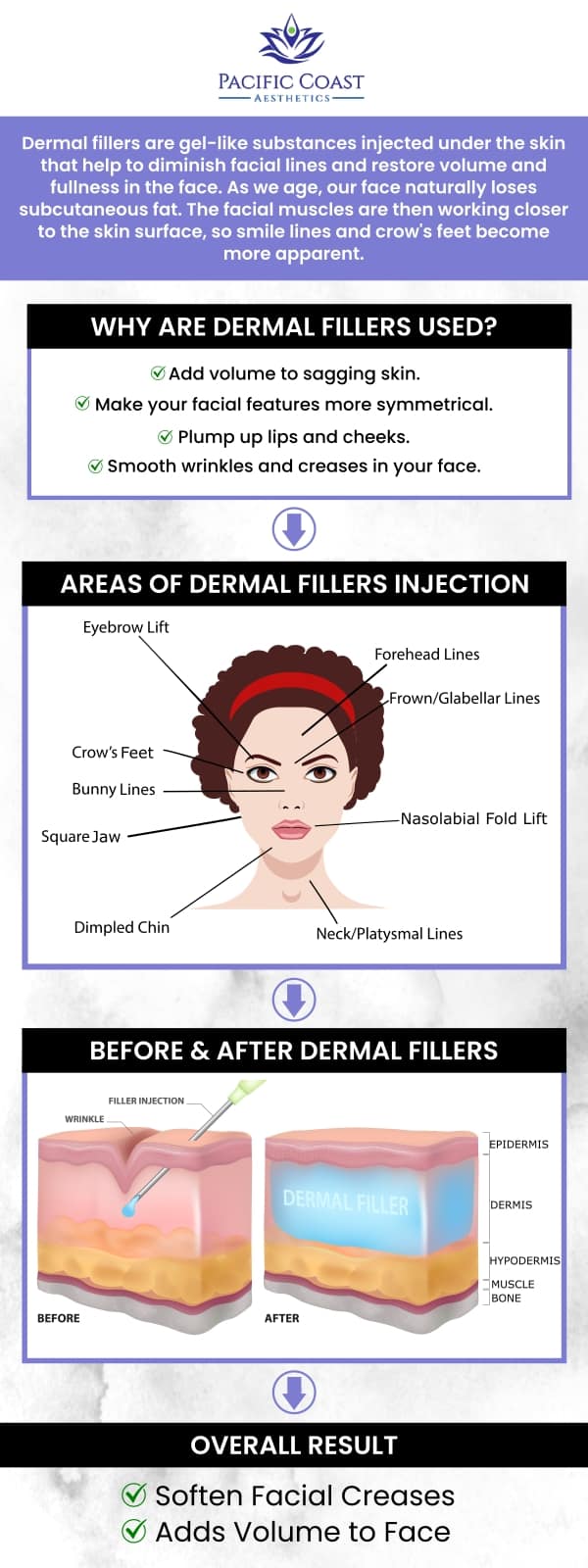 Dermal fillers are utilized to replenish hyaluronic acid levels in the skin while also stimulating the body's collagen production. April Umek, PA-C, at Pacific Coast Aesthetics provides a variety of dermal fillers that can be used on different areas of your face to give certain areas, like your cheeks, more volume. For more information, contact us today or simply book an appointment. We are conveniently located at 28 Seascape Village, Aptos, CA 95003.