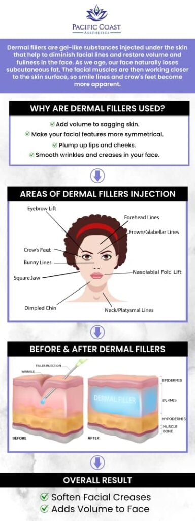 Dermal fillers are utilized to replenish hyaluronic acid levels in the skin while also stimulating the body's collagen production. April Umek, PA-C, at Pacific Coast Aesthetics provides a variety of dermal fillers that can be used on different areas of your face to give certain areas, like your cheeks, more volume. For more information, contact us today or simply book an appointment. We are conveniently located at 28 Seascape Village, Aptos, CA 95003.