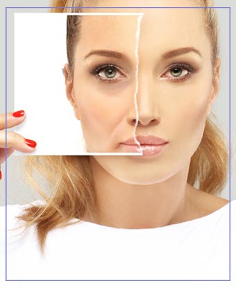Dermal Fillers Near Me in Aptos, CA