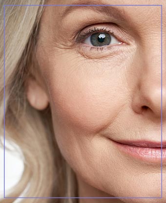 Dysport Treatment Near Me in Aptos, CA
