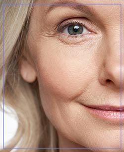 Dysport Treatment Near Me in Aptos, CA