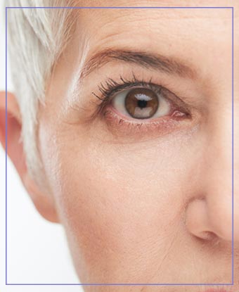 Microdermabrasion Near Me in Aptos, CA
