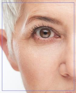 Microdermabrasion Near Me in Aptos, CA