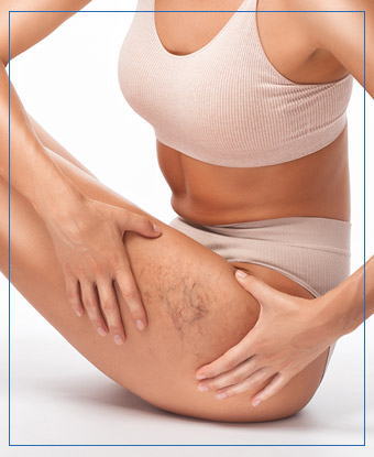 ClearV Treatment by Sciton Near Me in Santa Cruz, Aptos CA