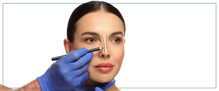 When Should You Consider Treatment for Bunny Lines in Aptos, CA?