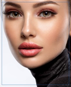 Lip Flip Treatment in Santa Cruz, Aptos CA Lip Flip Treatment in Santa Cruz, Aptos CA