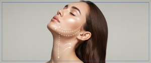 When Should You Consider a Nefertiti Lift for Neck Bands in Aptos, CA?